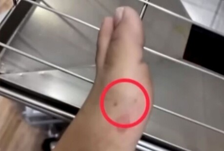 thumbimg